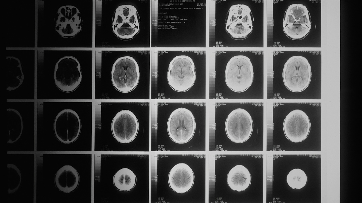 MSD buys Modifi for $1.3bn to boost oncology pipeline | pharmaphorum