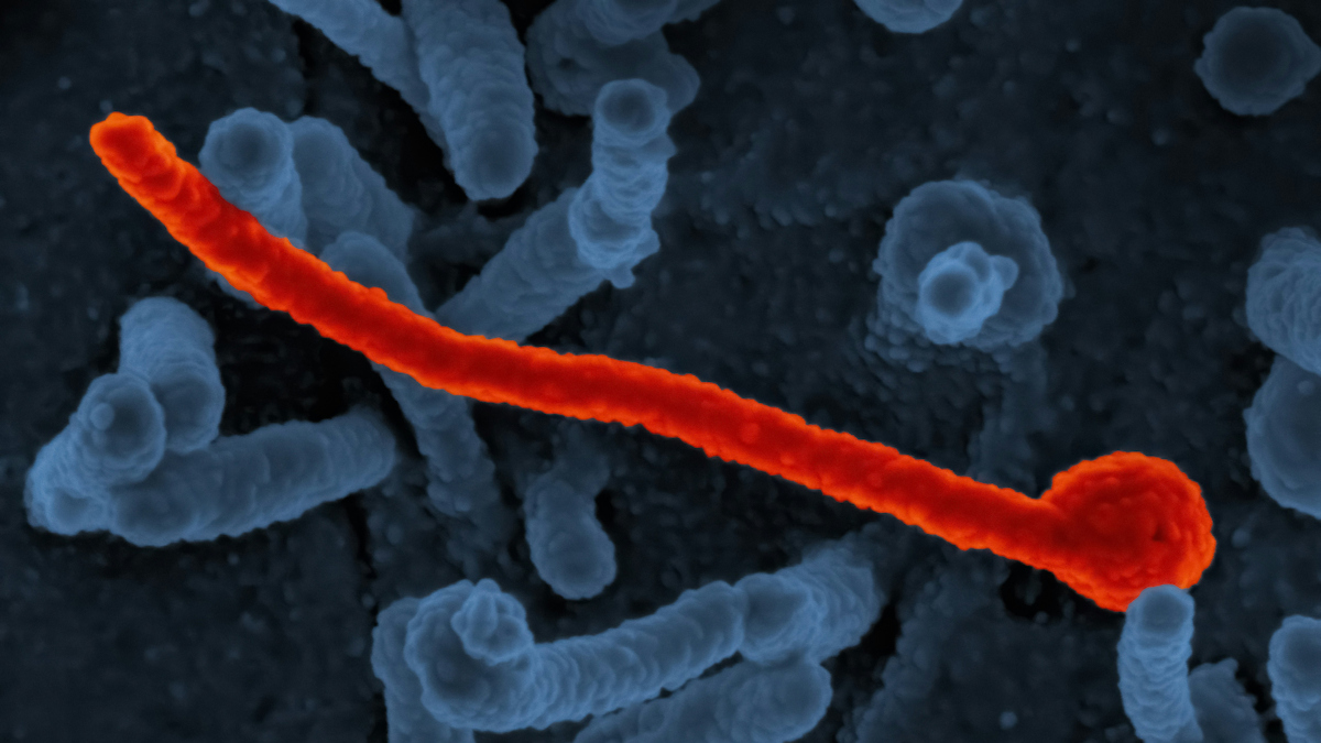 CEPI puts $60m behind three Ebola vaccine candidates