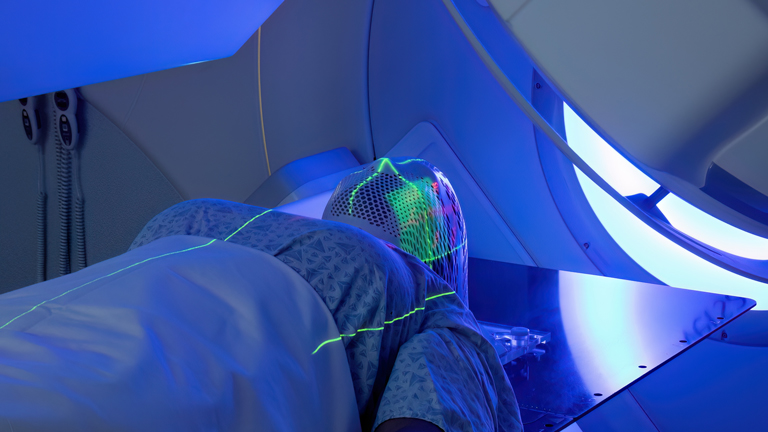 Radiotherapy Treatments for cancer