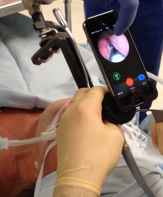 Endoscope-i device in action