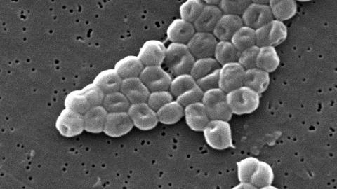 Acinetobacter baumannii