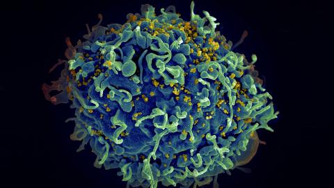 HIV, the AIDS virus (yellow), infecting a human cell