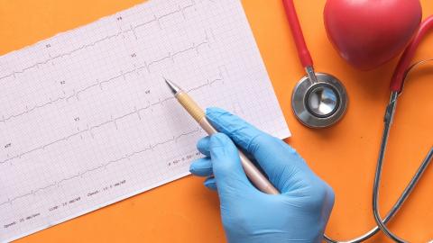 heart failure, ECG