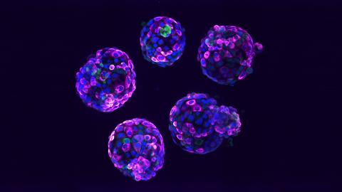 Human stem cell-based embryo model – Blastoids. Blue marks all nuclei, the green label marks cells of the inner cell mass, and the pink label is a readout of a ribosomal protein.