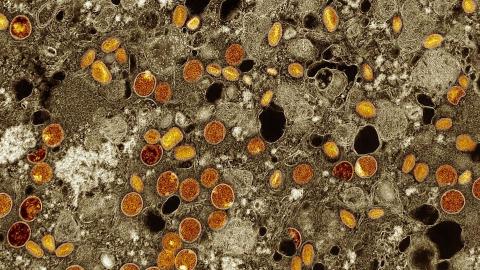 Colourised transmission electron micrograph of mpox virus particles (red/yellow) found within infected VERO E6 cells (brown)