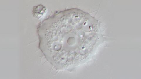 Pathogenic Acanthamoeba as seen under a light microscope