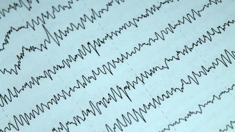 brain function scanner readout