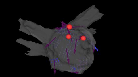 AI map of heart