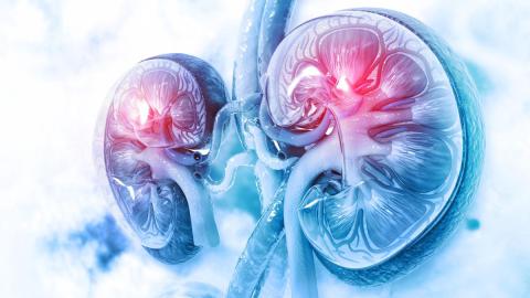 illustration of affected kidneys