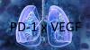 ASCO: Ivonescimab improves survival in NSCLC