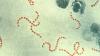 Philanthropic drive puts $140m behind strep A vaccine