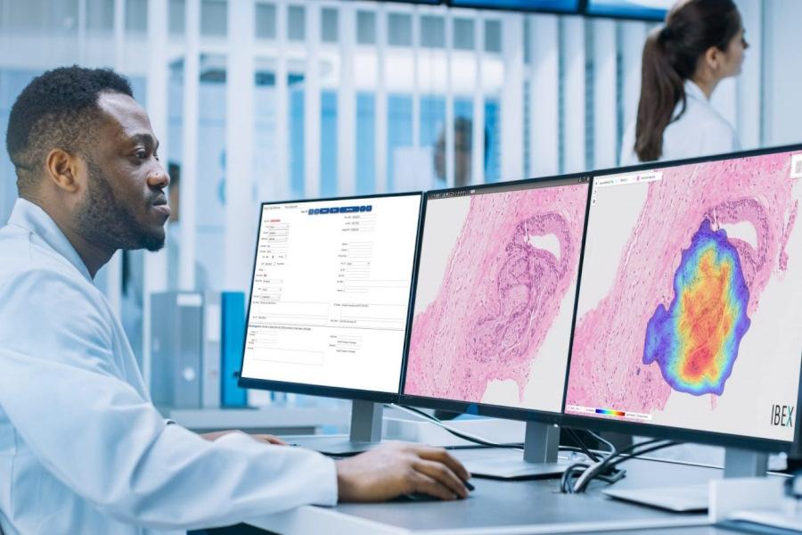 Wales expands NHS use of AI for cancer diagnosis