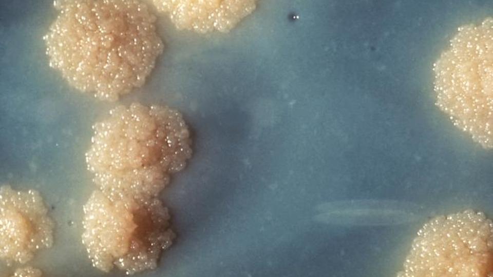 A close-up of a Mycobacterium tuberculosis culture