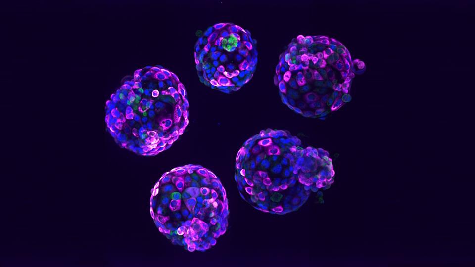 Human stem cell-based embryo model – Blastoids. Blue marks all nuclei, the green label marks cells of the inner cell mass, and the pink label is a readout of a ribosomal protein.