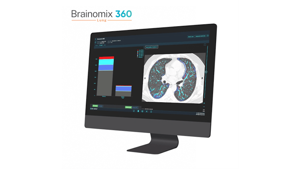 Boehringer backs Brainomix AI software for lung fibrosis