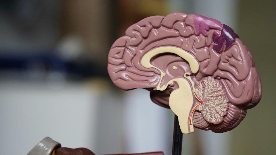 image of brain segment model for news article on acute ischaemic stroke