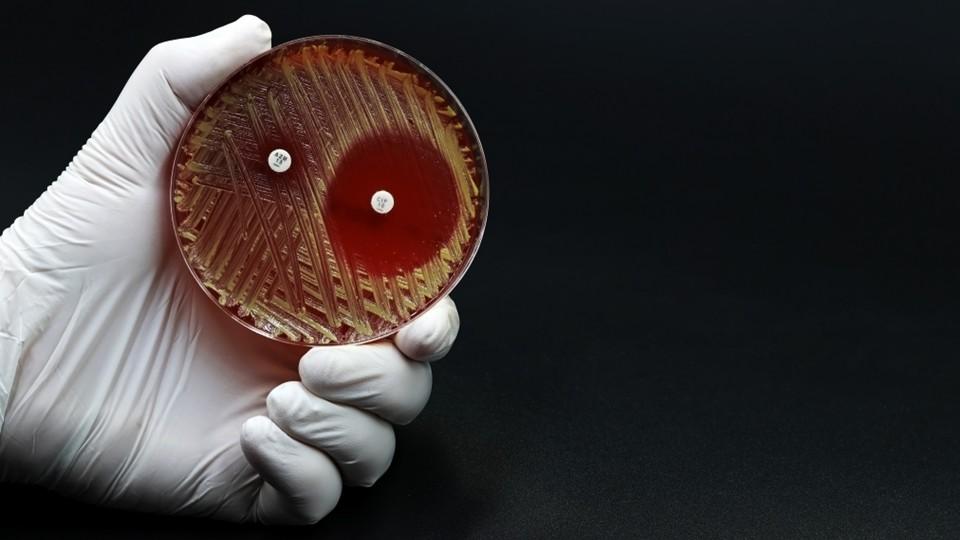 Gloved lab hand holds petri dish with AMR test