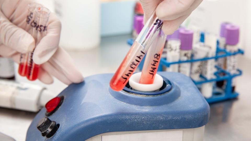 Test tubes being prepared for flow cytometry