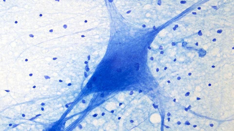 neuron under microscope