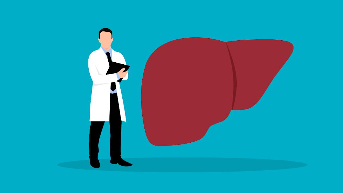Roche launches liver disease algorithm panel