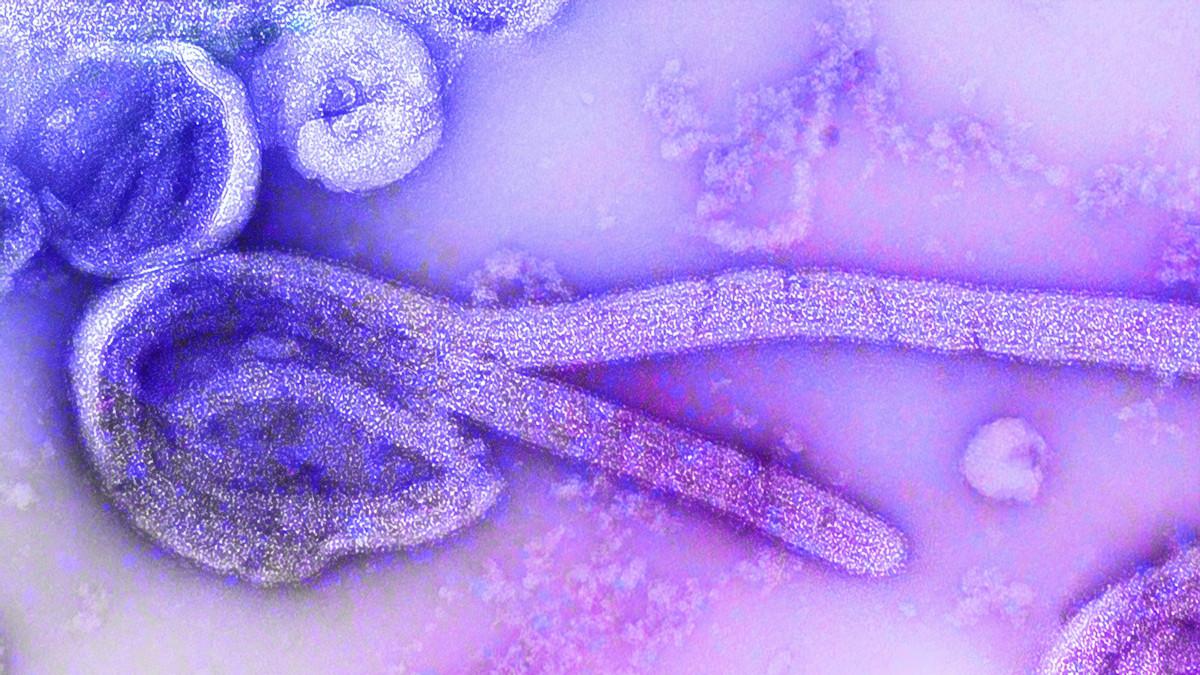 Ebola virus electron micrograph