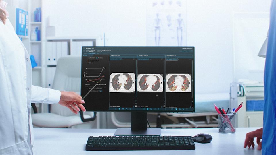e-Lung software in the clinical setting, by Brainomix