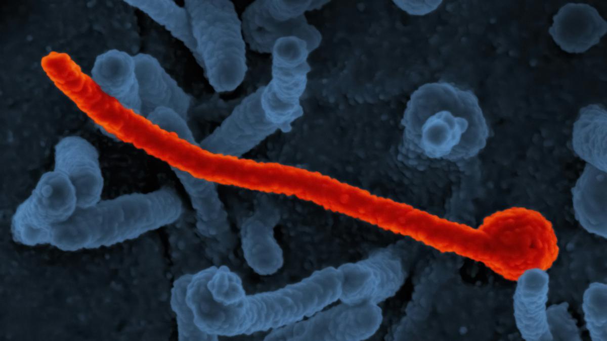 CEPI puts $60m behind three Ebola vaccine candidates