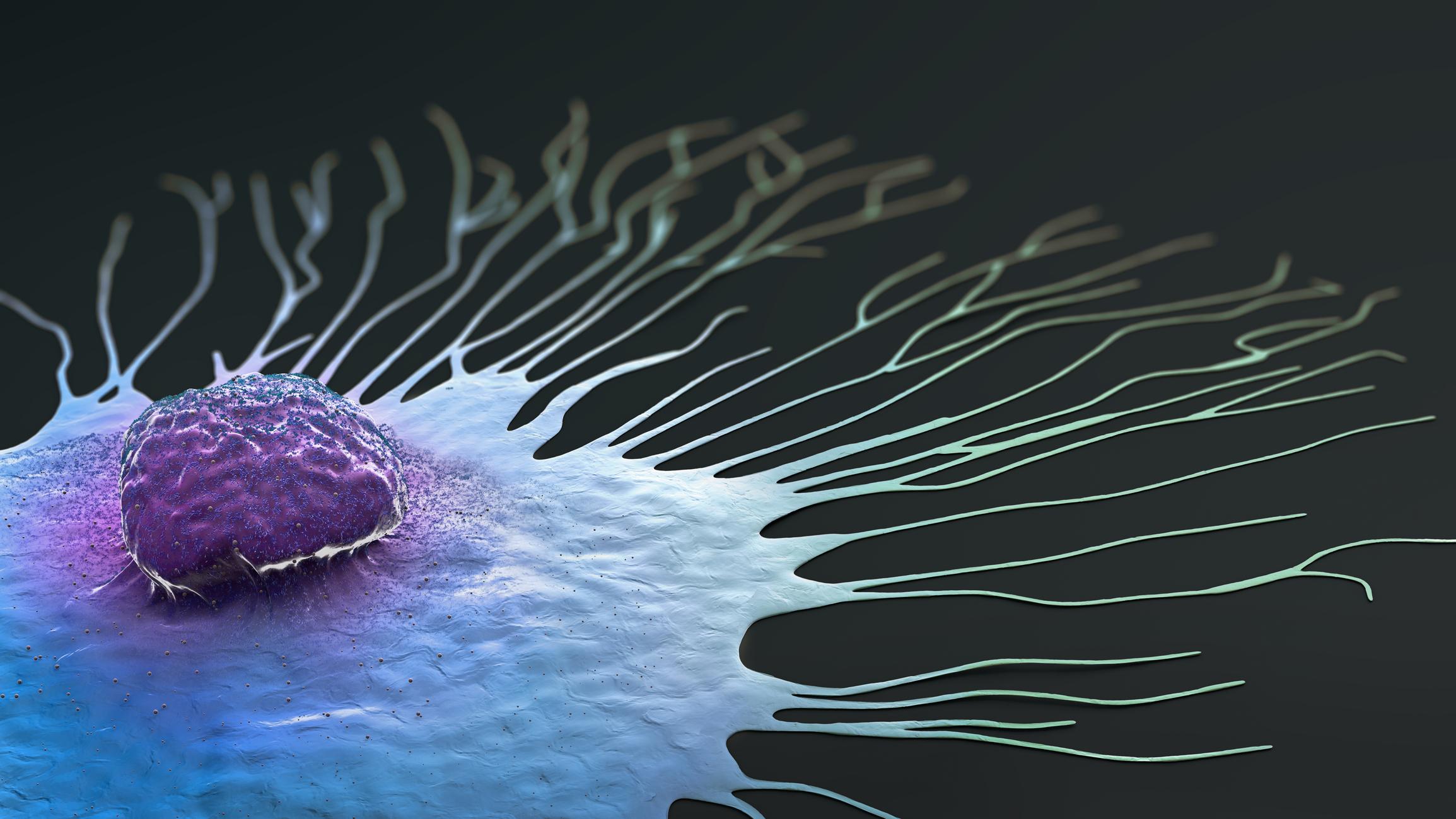 migrating breast cancer cell