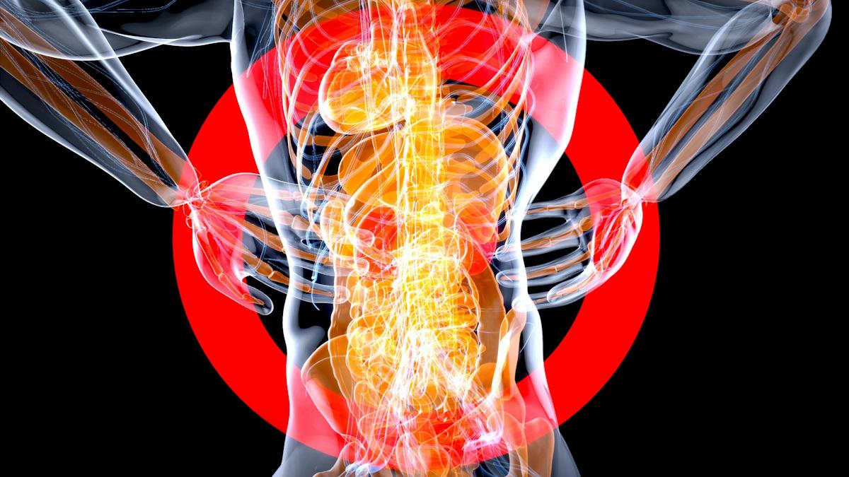 EULAR 26 hears of treatment advances in lupus