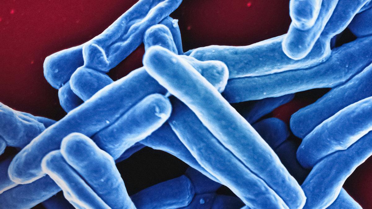 Scanning electron micrograph of Mycobacterium tuberculosis particles.