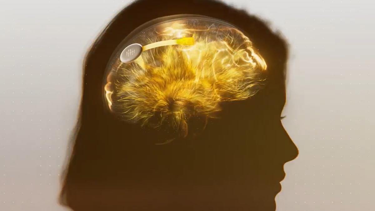 Precision Neuro breaks new ground in BCI technology