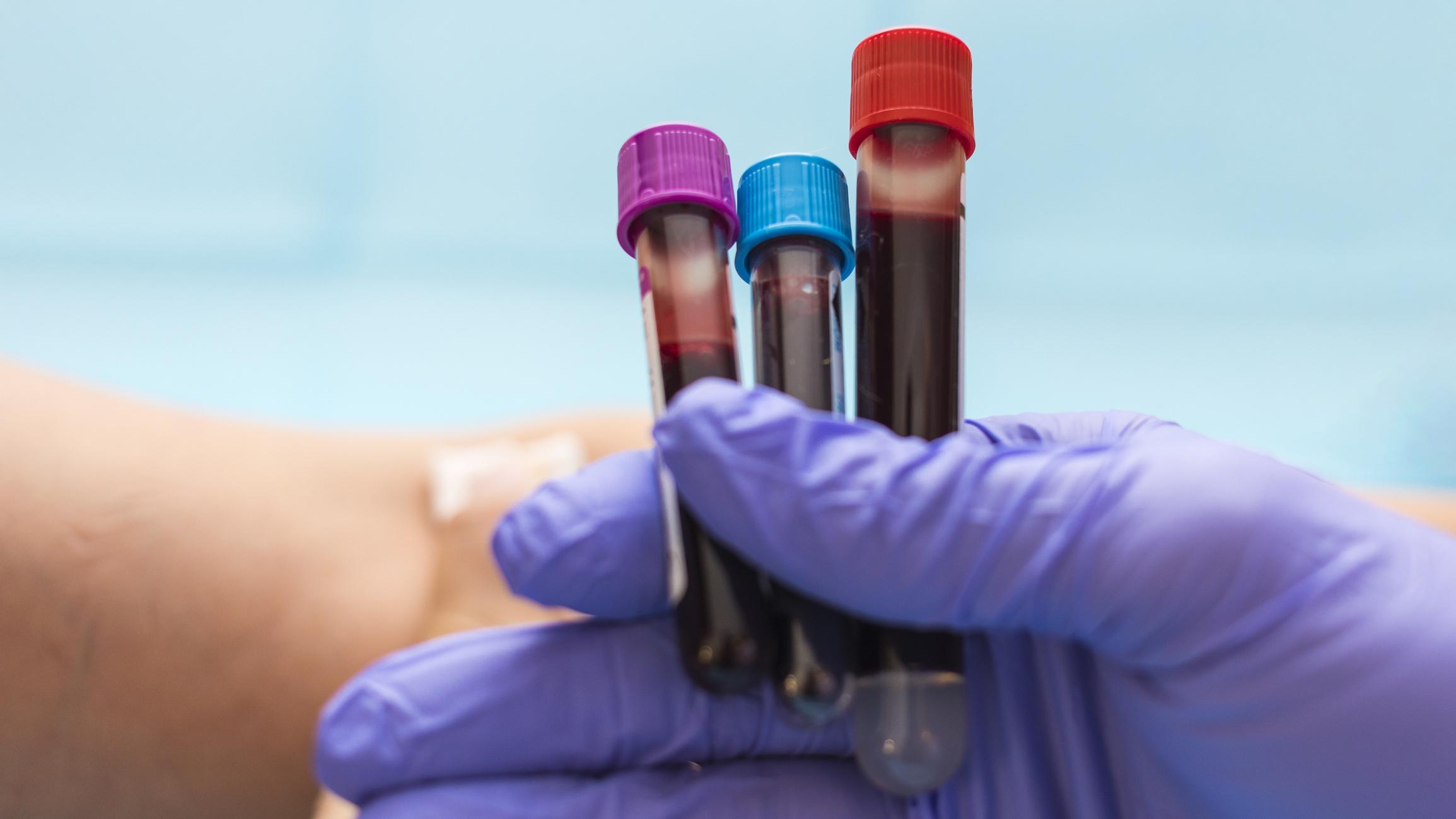 Blood tubes held by nurse