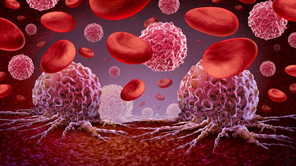 leukaemia