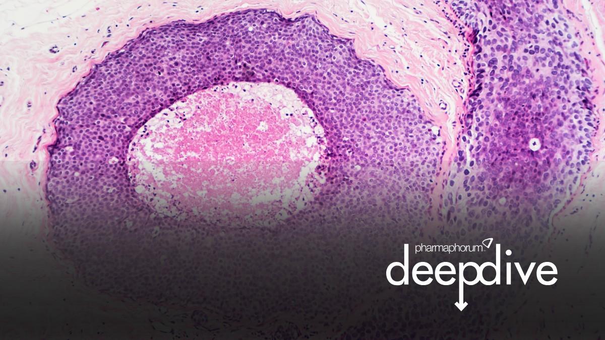 Oncology liquid biopsies