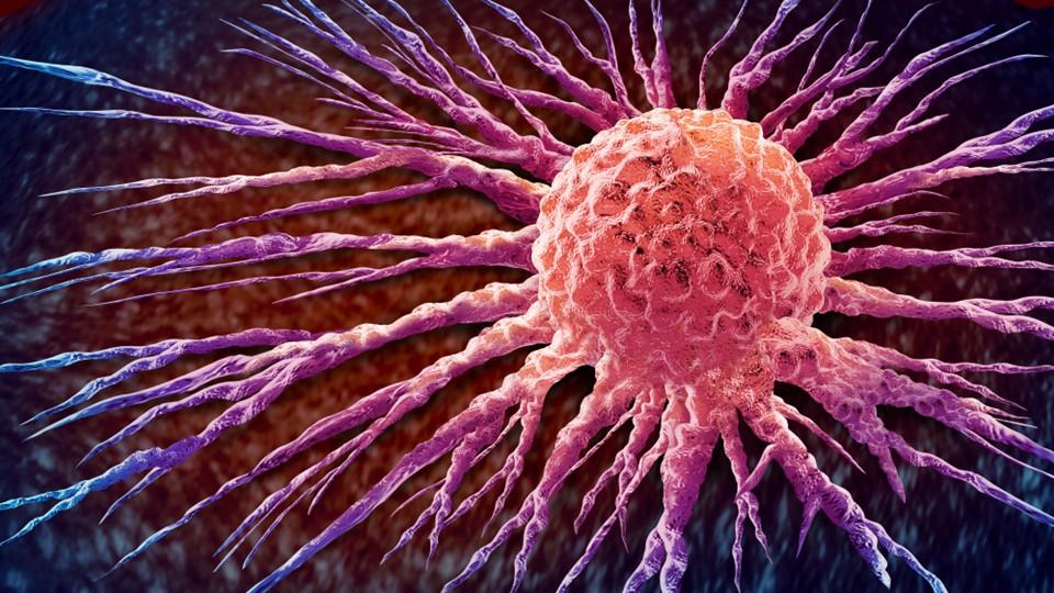 Solid tumour spreading