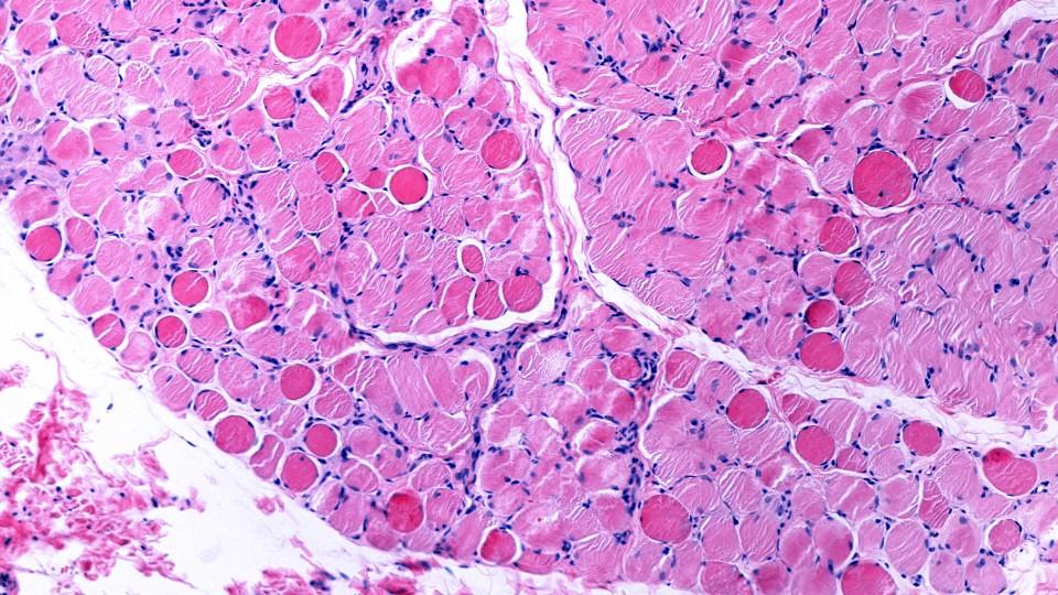Close up of muscle in DMD