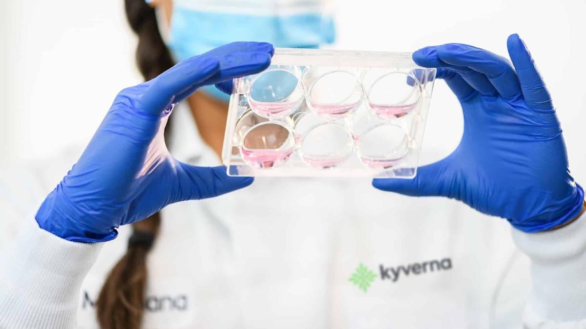 Kyverna builds case for CAR-T in stiff person syndrome