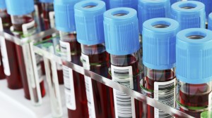 Cancer blood test firm Grail mulls IPO