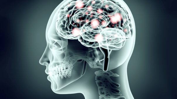 Vasopharm drug could limit damage caused by brain injuries