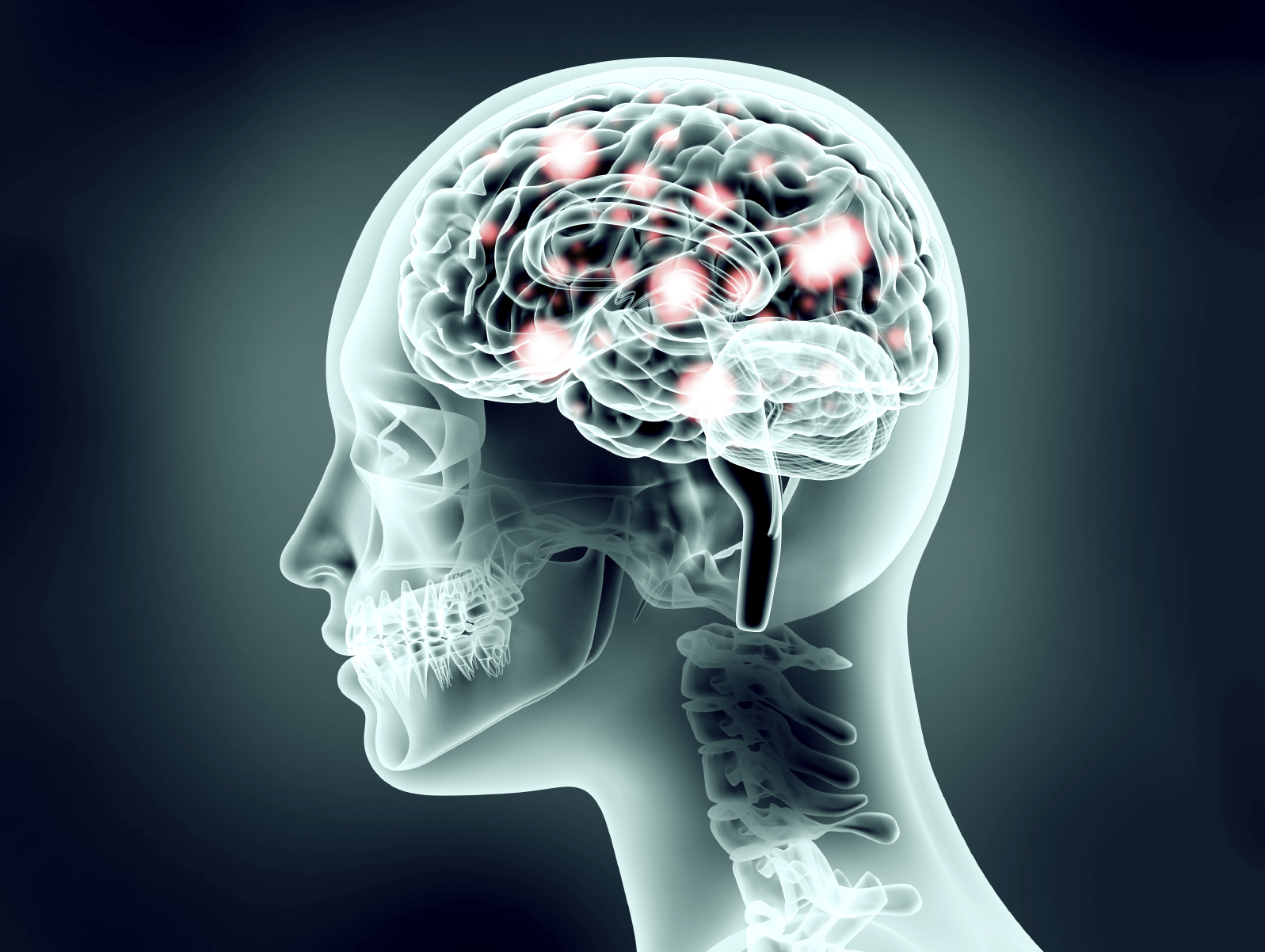 x-ray image of human head with brain and electric pulses