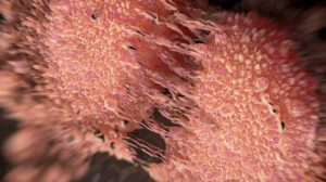 AZ’s cediranib falls short again in ovarian cancer combination