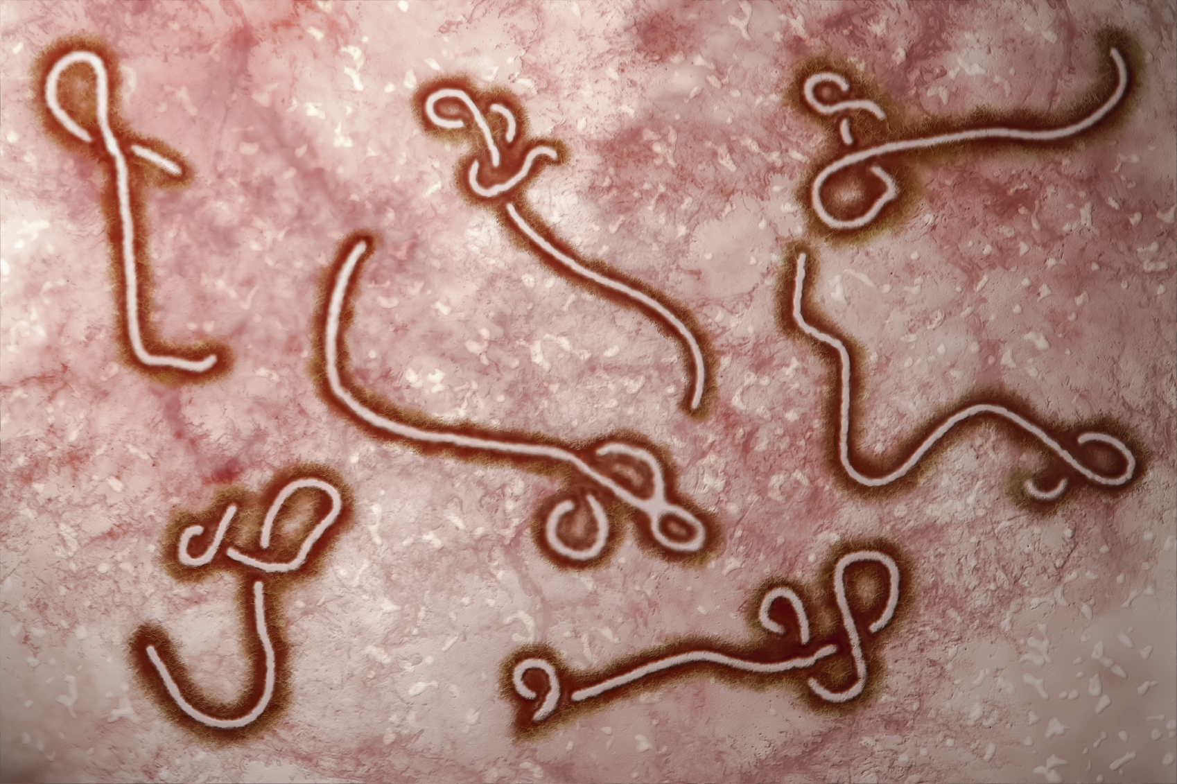 Microscopic view of Ebola Virus