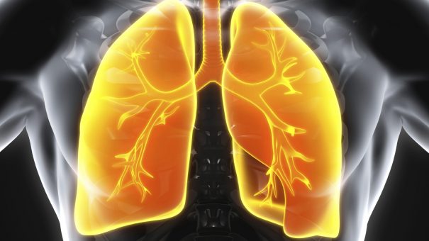 Owlstone’s breath-based lung cancer diagnostic could save 10,000 lives