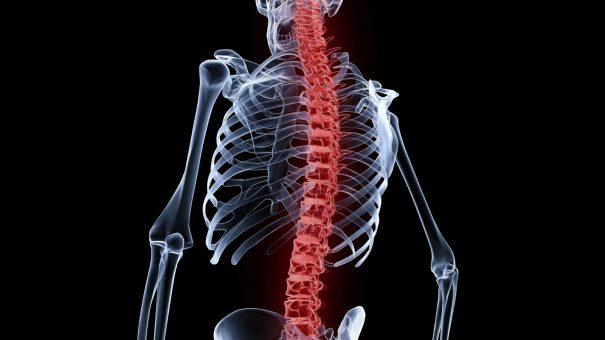 NICE backs Novartis’ Cosentyx for underdiagnosed back condition