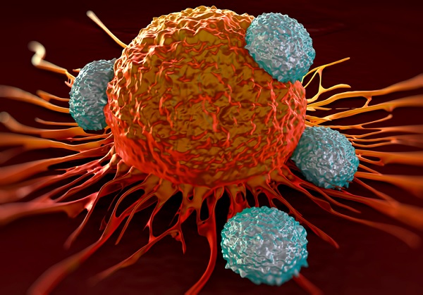 Cancer attacked by T cells 600