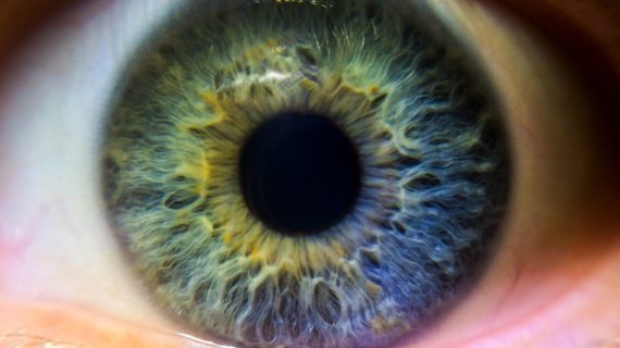 Aldeyra builds case for troubled dry eye drug reproxalap