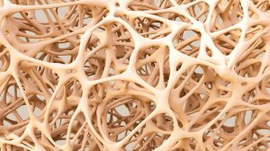 Safety restrictions spell the end for Servier osteoporosis drug
