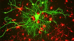 Neurocrine delays US Parkinson’s drug launch amid COVID disruption