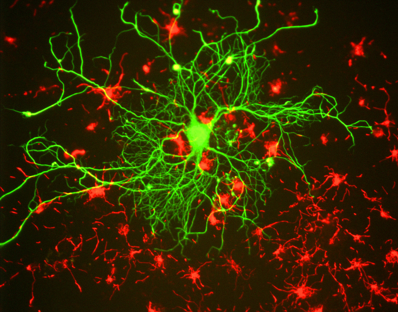 Neuron_in_tissue_culture
