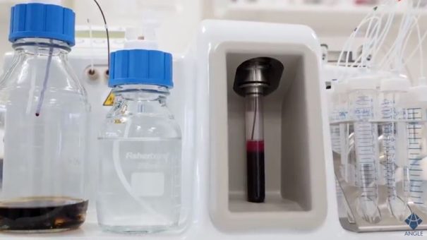 Liquid biopsy-based system could prevent cancer from spreading